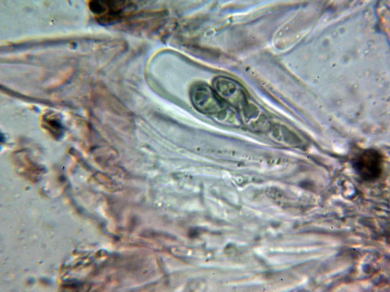 Buellia disciformis 10 - Asca 1